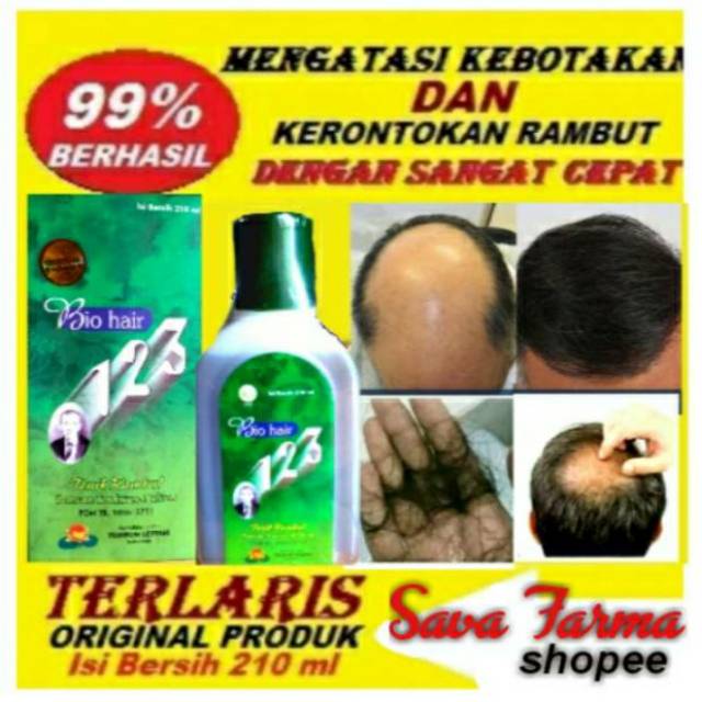 Obat Penumbuh Rambut Botak Dengan Cepat Obat Rambut Rontok Terbaik Shopee Indonesia