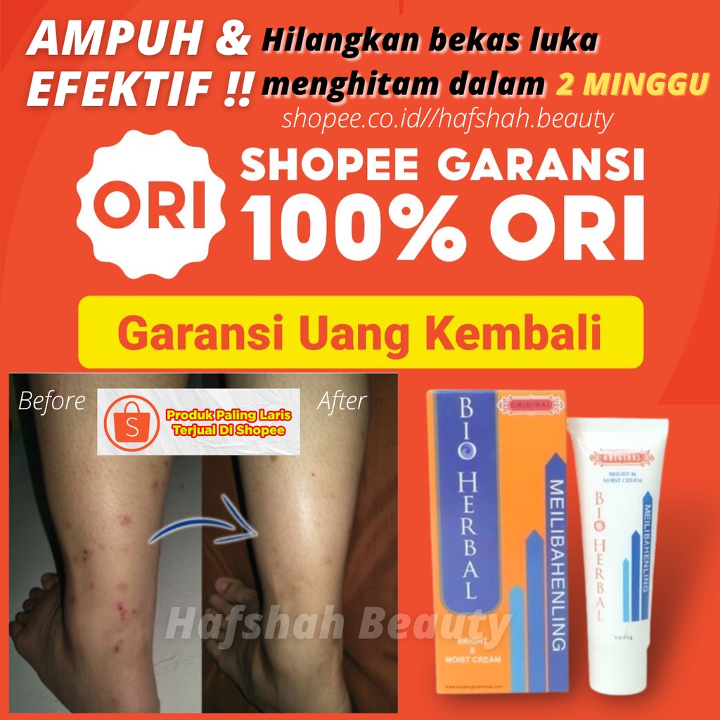 Penghilang bekas luka hitam koreng luka di kaki luka di tangan luka di wajah luka bakar luka hitam l