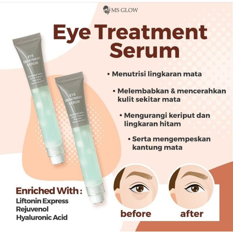 EYE CREAM MS GLOW - EYE DARK CIRCLE CREAM| EYE TREATMENT SERUM MS GLOW / ms glow cream mata