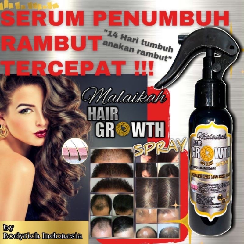 Serum Obat Penumbuh Rambut Botak dan Rontok Parah Malaikah Hair Growth