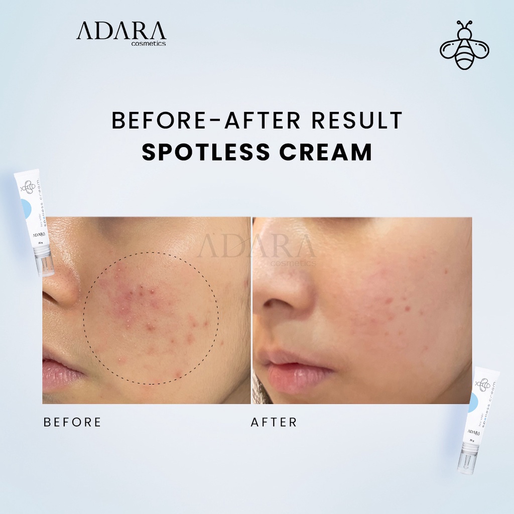 ADARA Bee White Spotless Gel - Cream 20gr