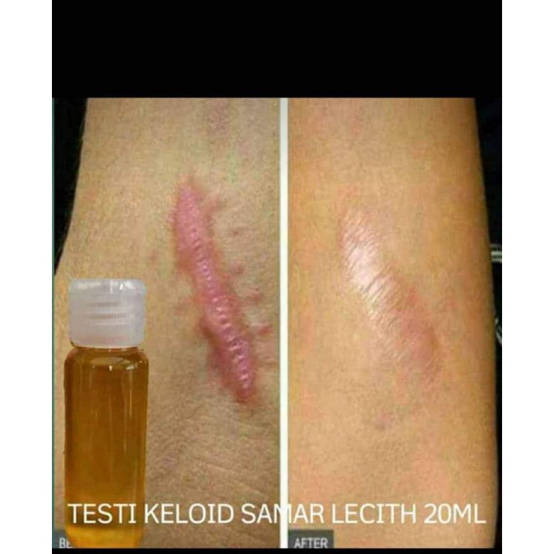 

lecith hemat isi 30 ml