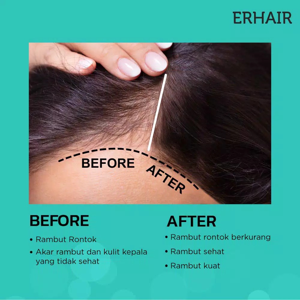 ERHAIR Hairgrow Tonic 60 ml - Tonik Rambut Anti Rontok ~ ORIGINAL 100%