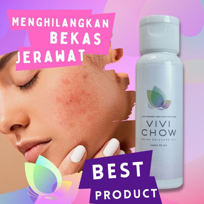 Penghilang Bekas Jerawat Vivi Chow Treatment Jerawat vivichowers vivichow2018 vivichow penghilangbekasluka penghilangbekaslukaoriginal penghilangbekaslukacepat penghilangbekaslukabakar penghilangbekaslukaampuh penghilangbekaslukacaesar