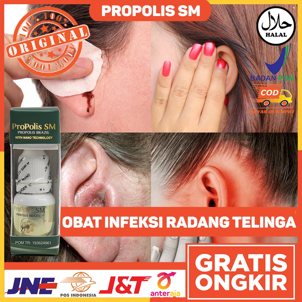 Jual Obat Infeksi Radang Telinga Obat Infeksi Telinga Kronis Obat Telinga Berair Obat