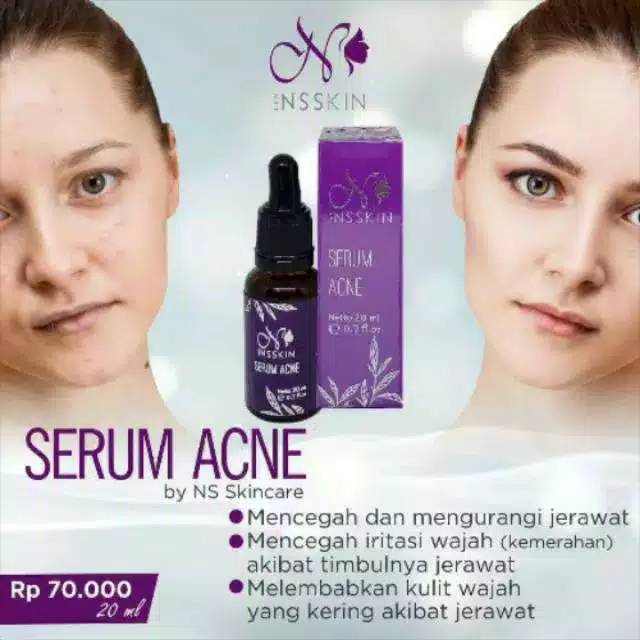 NS skincare serum acne