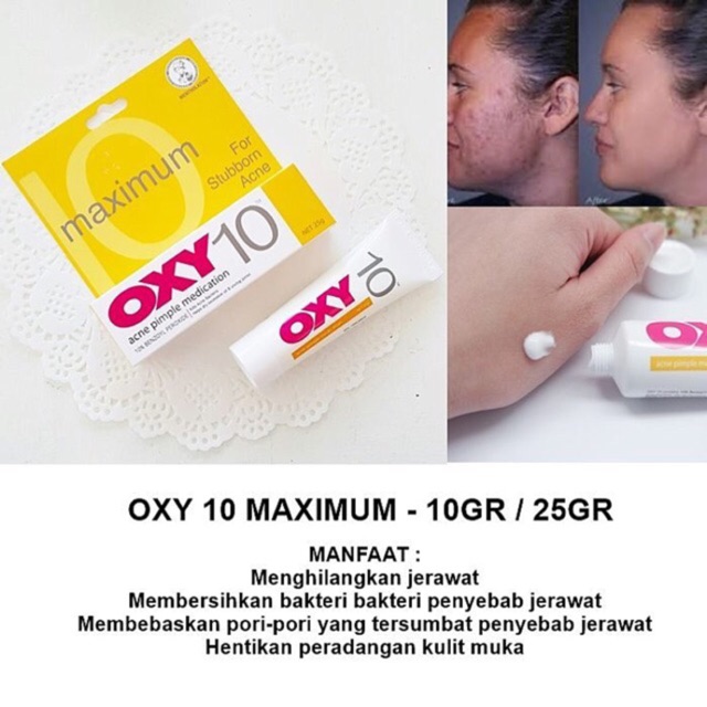 OXY 10 - Jerawat Kempes dlm 1 malam! - oxy10 25gr - JAMINAN ORIGINAL