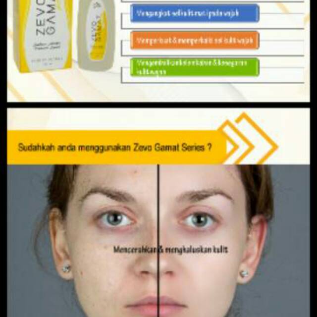 ZEVO GAMAT KRIM & FACIAL WASH