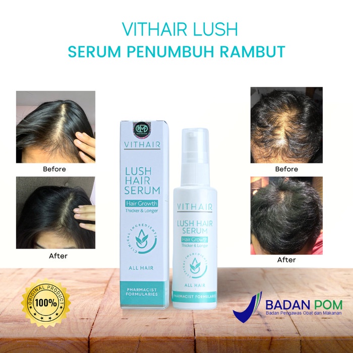 ( 𝟭𝟬𝟬% 𝐁𝐞𝐫𝐠𝐚𝐫𝐚𝐧𝐬𝐢 𝐎𝐫𝐢 ) Vithair Lush hair Serum 100Ml Solusi Untuk Mempertebal Menghitamkan Dan Membuat Rambut Berkilau Original Bpom