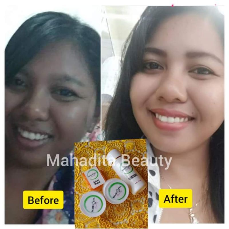 Pemutih Wajah | Cream Pemutih Wajah | Cream Mahadita