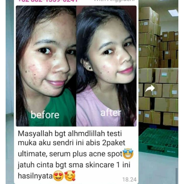 paket nbs ultimate | NBS Ori | nbs original | nbs sumedang | nbs bandung