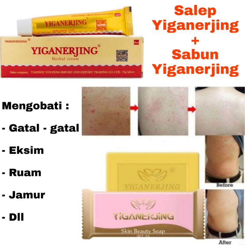 Yiganerjing Salep &amp; Sabun Obat Eksim Gatal Psoriasis Dermatitis - Salep Yiganerjing Krim Obat Herbal Gatal