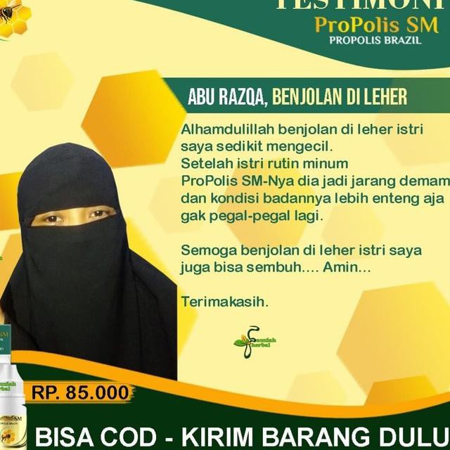 Benjolan di Jidat / Kening, Penghancur Benjolan Tumor, Lipoma, Kista,  SM Brazil .