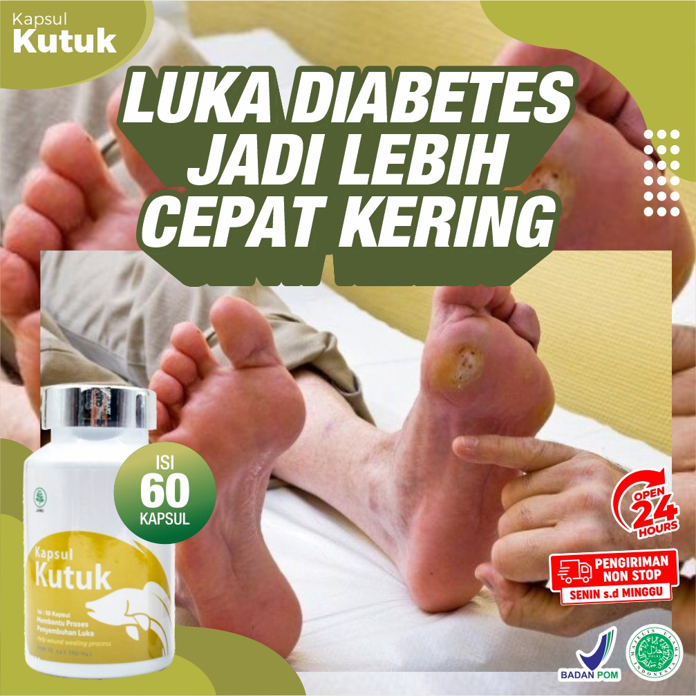 Paket Diabetes 2 Botol Kapsul Kutuk - Kapsul Pengering Luka Diabet Ekstrak Albumin Ikan Gabus Percepat Penyembuhan Luka Pasca Operasi Sesar Caesar Luka Bakar