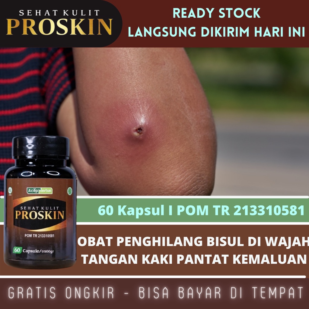 Obat Bisulan, Obat Bisul Bernanah, Obat Bisul Menir, Obat Bisulan Di Kaki, Obat Bisul Bernanah, Obat Bisul Untuk Anak &amp; Dewasa, Obat Bisul di Wajah, Obat Bisul Di Pantat, Obat Bisul Di Kemaluan, Obat Bisul Biar Gak Tumbuh Lagi Dengan ProSkin