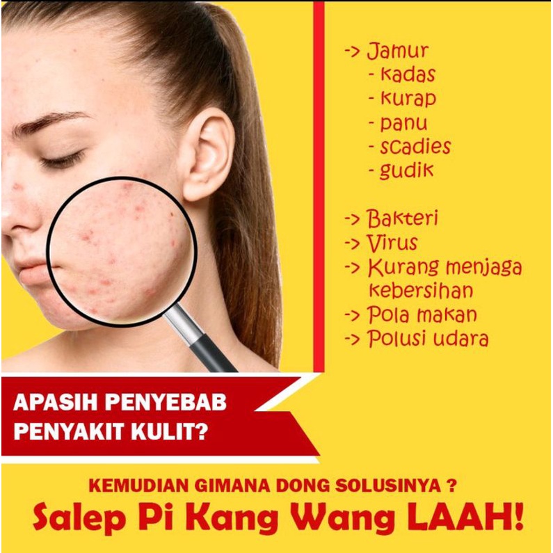 Salep Pikangwang obat kulit herbal eksim salep KL berkualitas