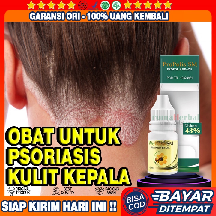 Obat Psoriasis Kulit Kepala, Obat Kulit Kepala Gatal Parah, Obat Gatal Kulit Kepala - copyrightRherb