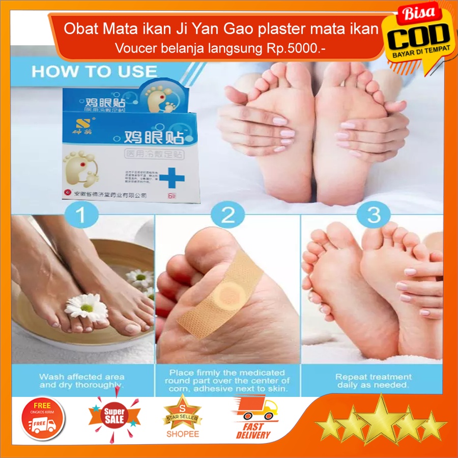 Obat Mata ikan Ji Yan Gao plaster mata ikan plester kutil dan penghilang kapalan kaki