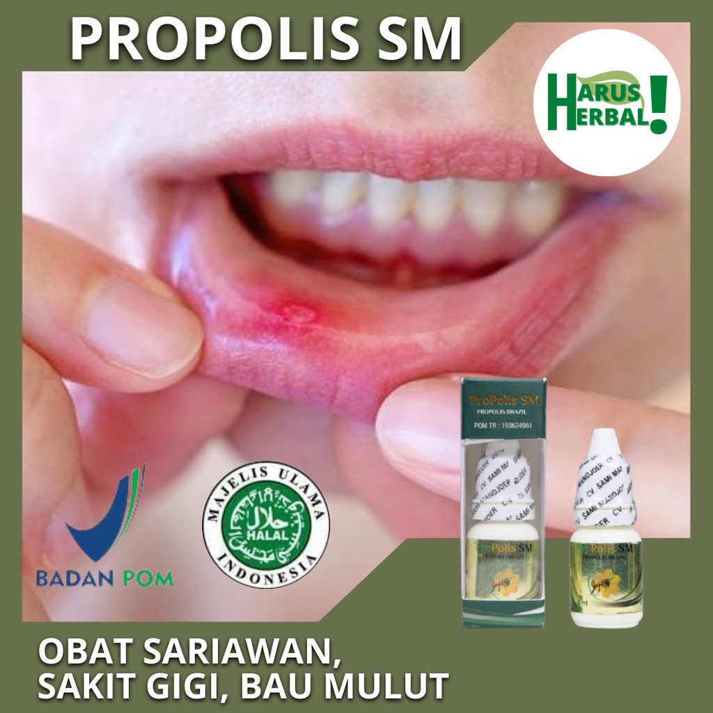 Jual Obat Sariawan Alami Obat Herbal Sariawan Di Bibir Obat Sariawan Di Lidah Obat Sariawan 1859