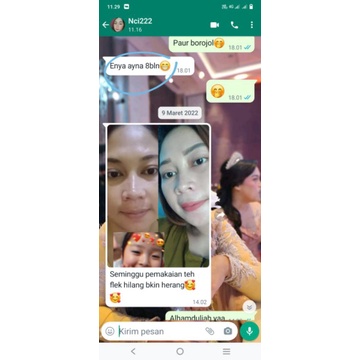 ORI HYDE BEAUTY / HYDE SKINCARE / KRIM HYDE / SKINCARE VIRAL /SKINCARE AMAN /PAKET PEMUTIH AMAN/ JER