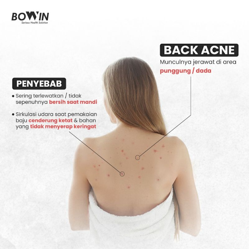 BOWIN Acne Spray ~ Obat Jerawat untuk Maskne, Back &amp; Chest Acne 75ml