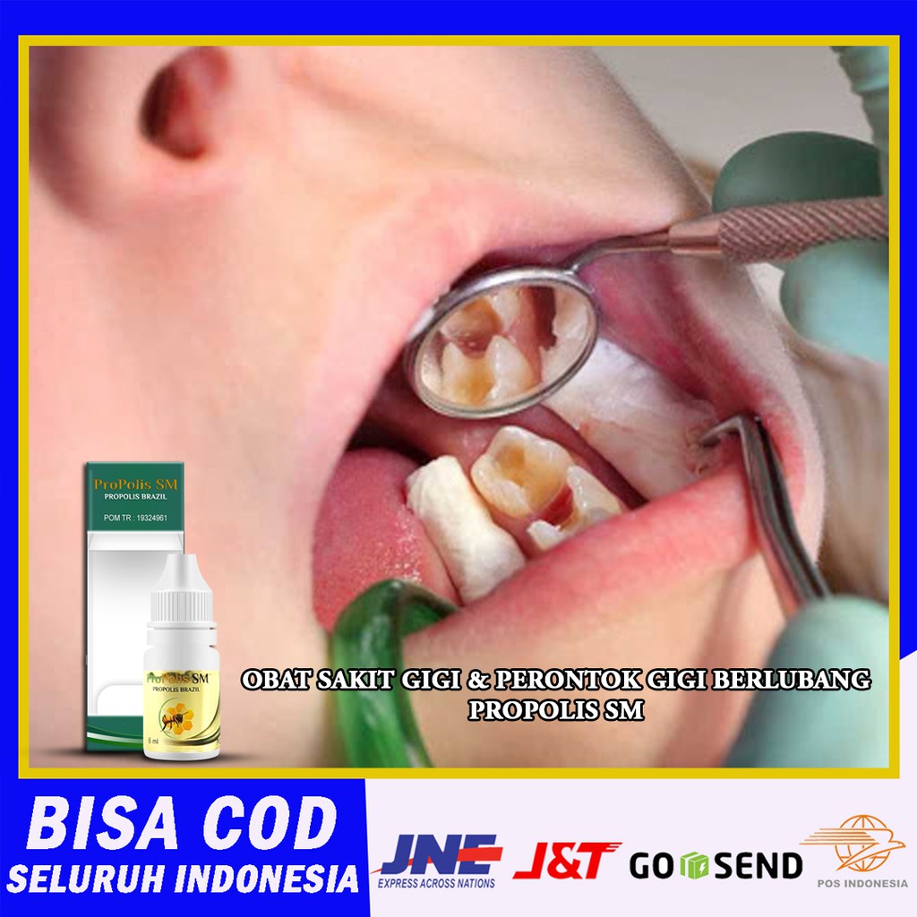 Obat Gigi Berlubang,Perontok Gigi Bolong,Obat Sakit Gigi Gigi Ngilu,Pencegah Gigi Berlubang | PSM