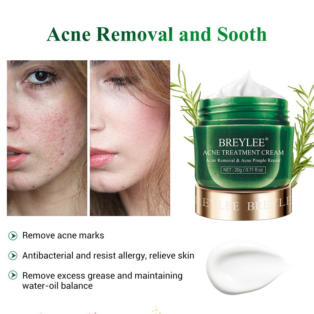 BREYLEE Acne Cream Obat Jerawat Krim Remover Acne Moisturizer Whitening Skincare 20g GIRLSNEED77