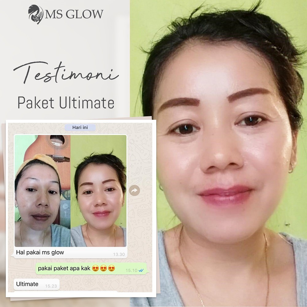 Msglow Paket Ultimate Series Msglow Ultimate Cream Ms Glow Original Skincare Aman Shopee Indonesia