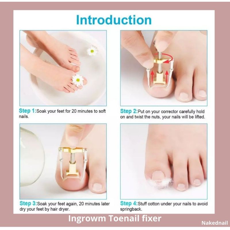 korektor jempol kuku kaki toenail ingrown correction toenail fixer