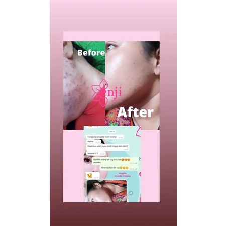 TERAMPUH!! Skincare Bpom Cream Pemutih Wajah 