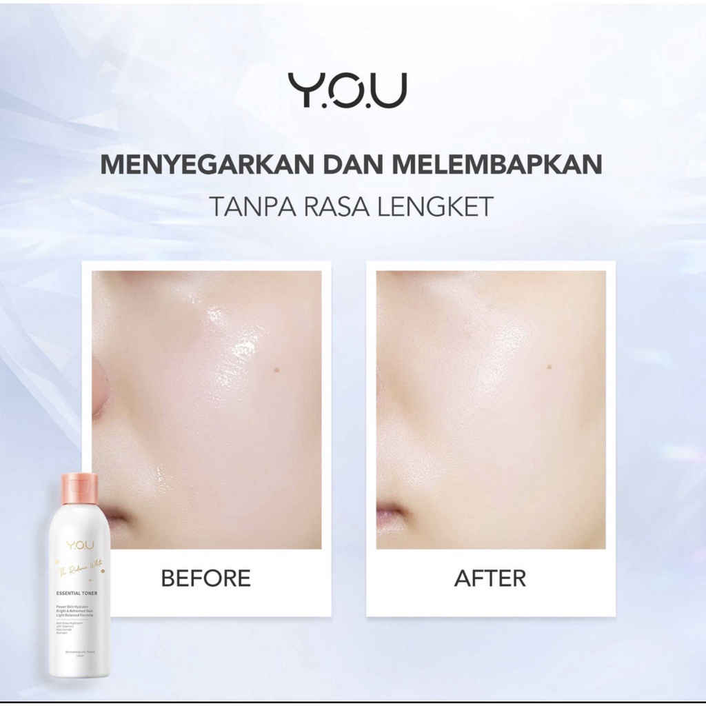 YOU Radiance White Essential Toner 100ml [Menenangkan, Menghidrasi &amp; Regenerasi Kulit] | Hydrate Toner