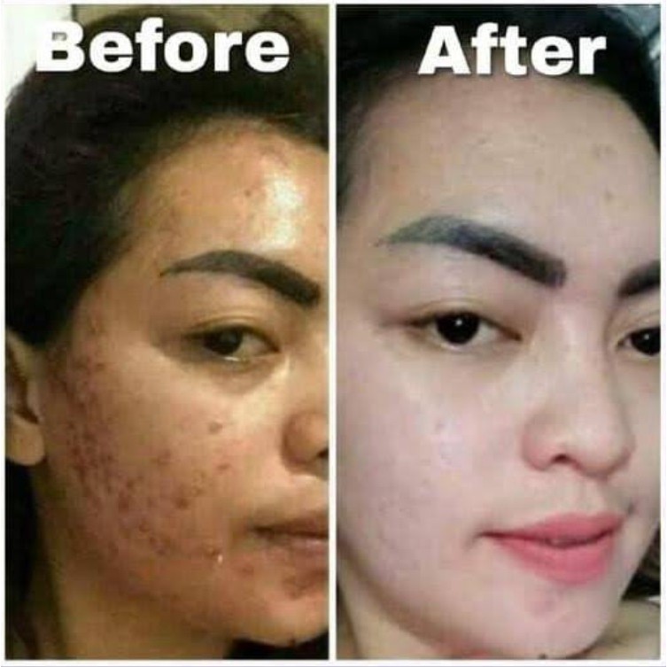 SABUN Wajah Muka TZUKI PEMUTIH KULIT ORIGINAL 100% BPOM PREMIUM Whitening Bukan Dosting QM Klinskin