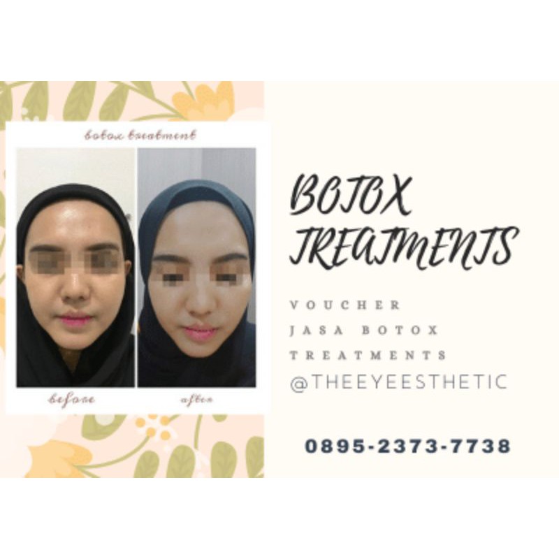 Voucher jasa botox