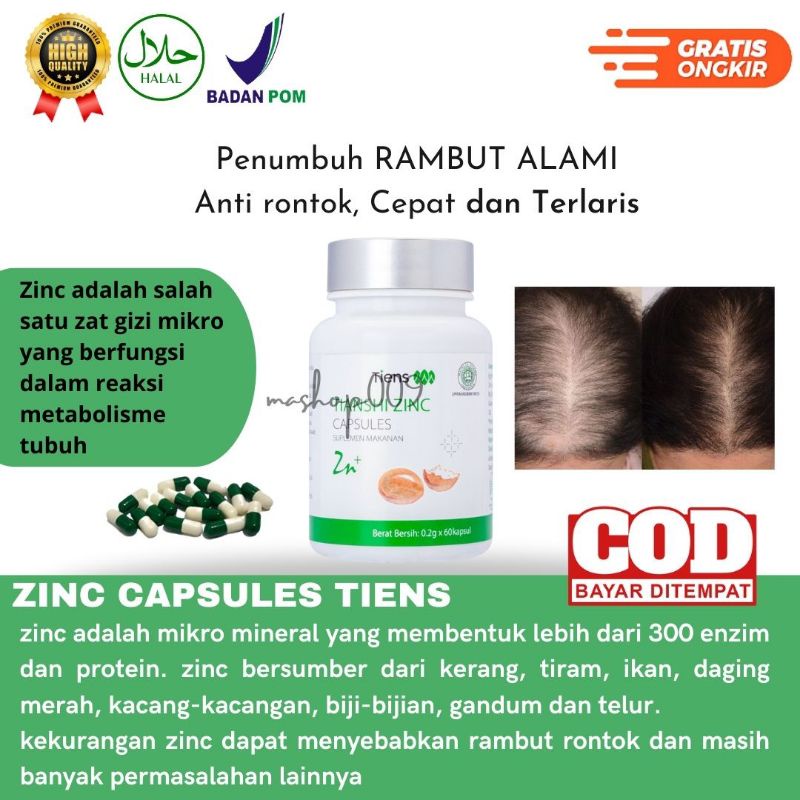 ZINC TIENS PENUMBUH RAMBUT ALAMI (anti rontok, menumbuhkan rambut baru)2