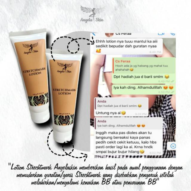 Stretchmark Lotion Angela Skin