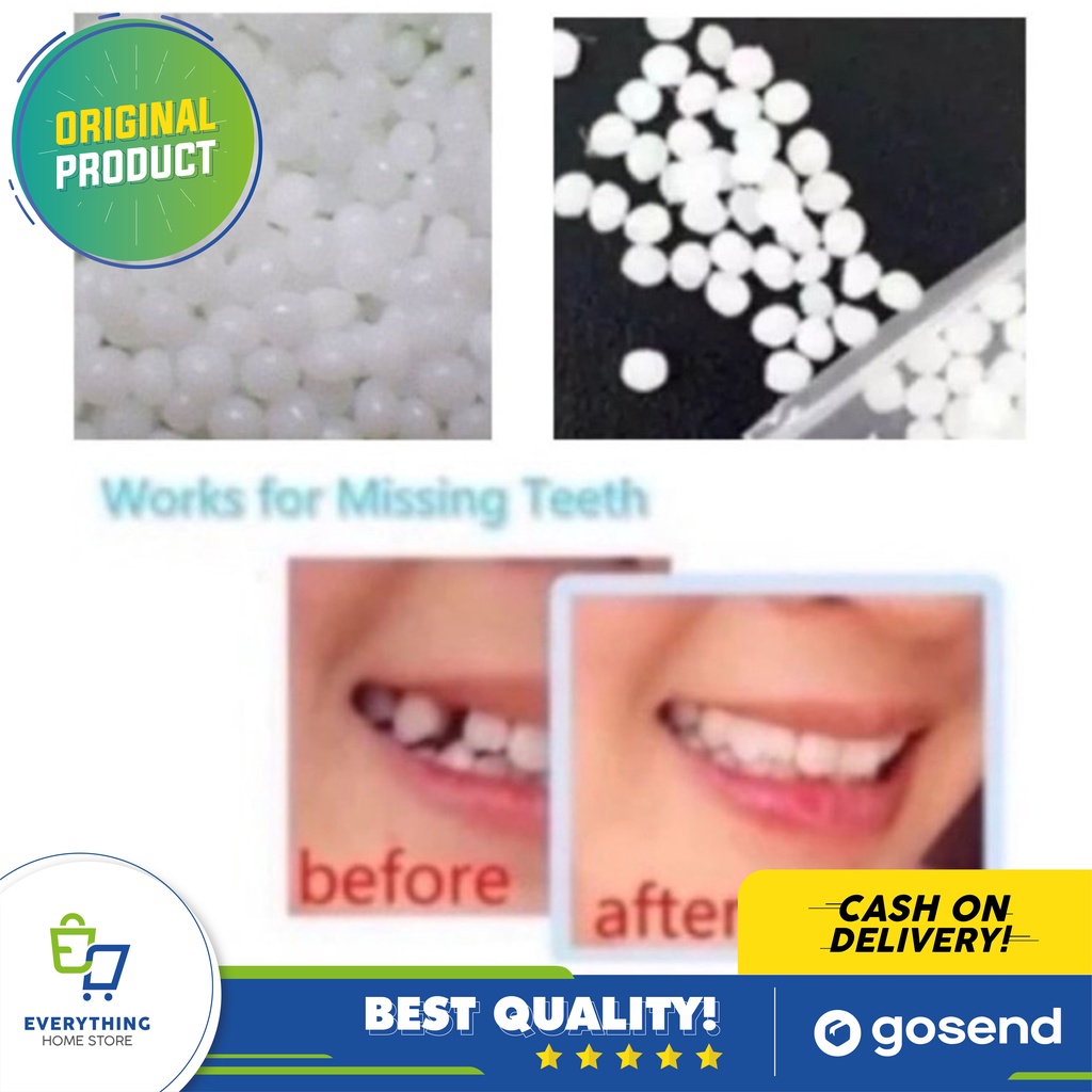 Fident Penambal Gigi EHS