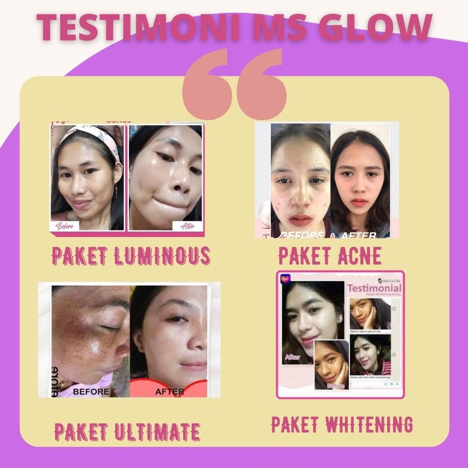 MS GLOW ALL PAKET WAJAH / MS GLOW PAKET WAJAH ORIGINAL / MSGLOW SKINCARE BPOM / CREAM PEMUTIH WAJAH