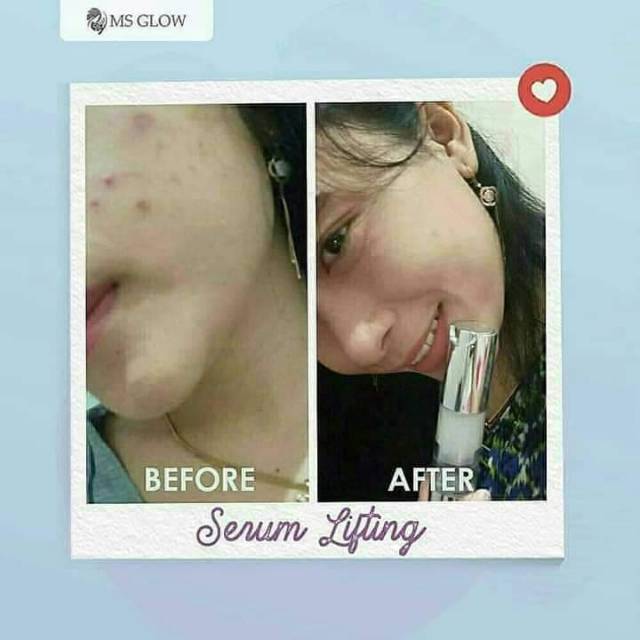 MS GLOW Serum Lifting GLow (untuk mengencangkan kuLit wajah)