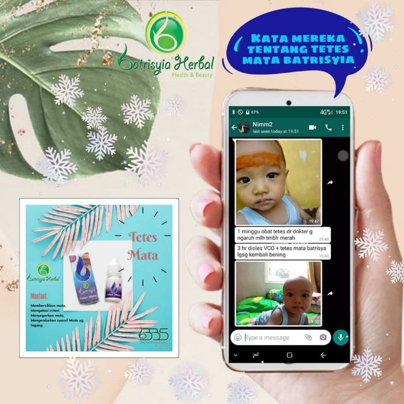 (BISA COD/ BAYAR DI TEMPAT) Obat tetes mata anak / obat tetes mata bayi/tetes mata anak bengkak merah berdarah bintitan belekan aman untuk bayi/ tetes mata iritasi anak