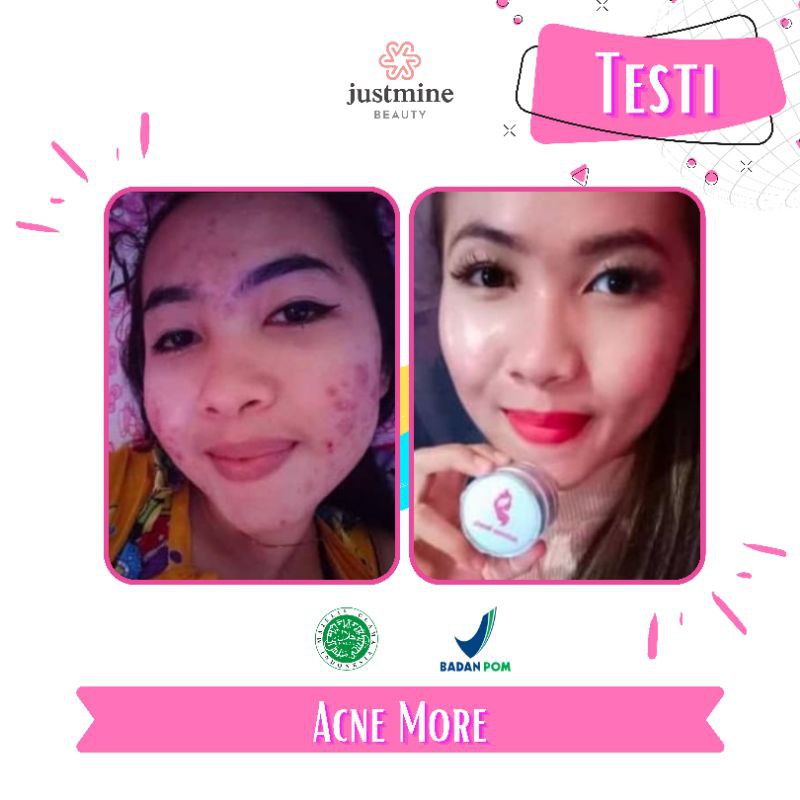 Paket isi 4 Justmine Beauty Skincare All Varian Series - Paket Night Glow Remove Spot AcneJelly