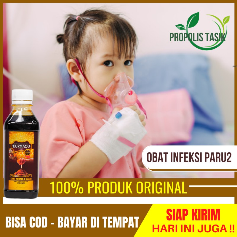 Obat Infeksi Paru Paru, Radang Paru Paru Pada Anak, Bronkopneumonia, Penyakit Paru Paru Akut KURMAQU