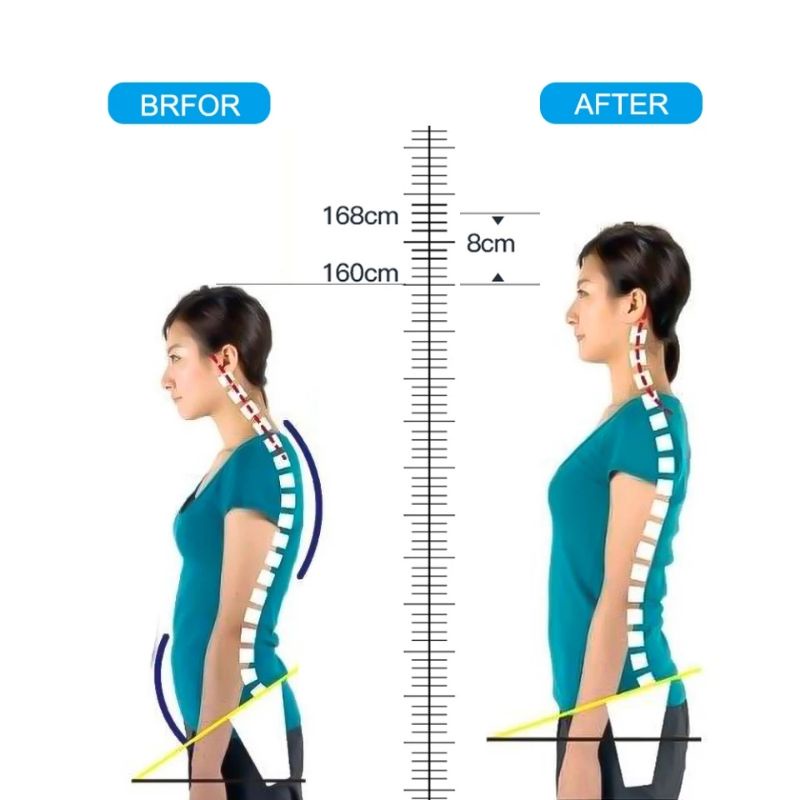 POSTURE CORRECTOR TALI PENYANGGA KOREKTOR PUNGGUNG BACK KOREKSI PENEGAK PUNDAK BUNGKUK PUTIH