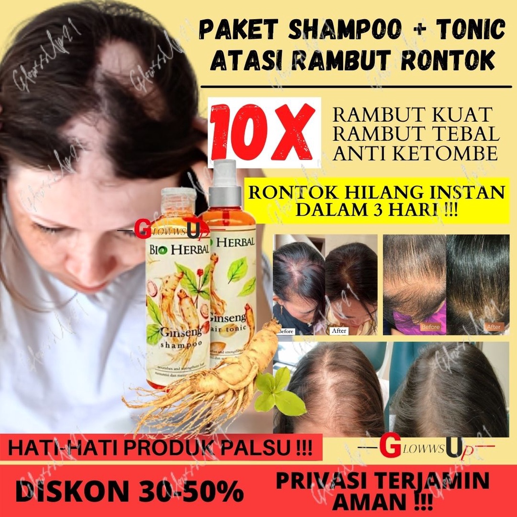 PENUMBUH RAMBUT KEBOTAKAN - SHAMPO PENUMBUH RAMBUT - BIO HERBAL GINSENG PAKET SHAMPO &amp; HAIR TONIC ORIGINAL