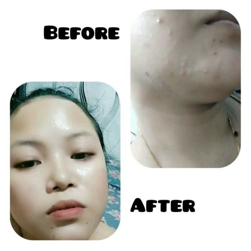 NBS SKINCARE ULTIMATE  ECER TERMURAH/ NBS NIGHT CREAM/DAY CREAM/FACE TONER/FACIAL WASH