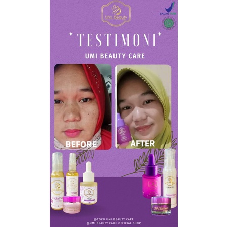 paket skincare UBC By Umi Alfatih