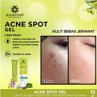 ★ BB ★ AZARINE Anti Acne SERIES - Cleansing Foam 60ml - Acne Spot Gel 15gr - Anti Acne Serum 20ml