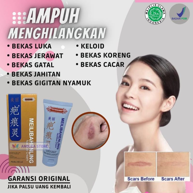Cream Penghilang Bekas Luka Lama Hitam Koreng Jerawat Bopeng Meilibahenling Melibahenling Ampuh BPOM
