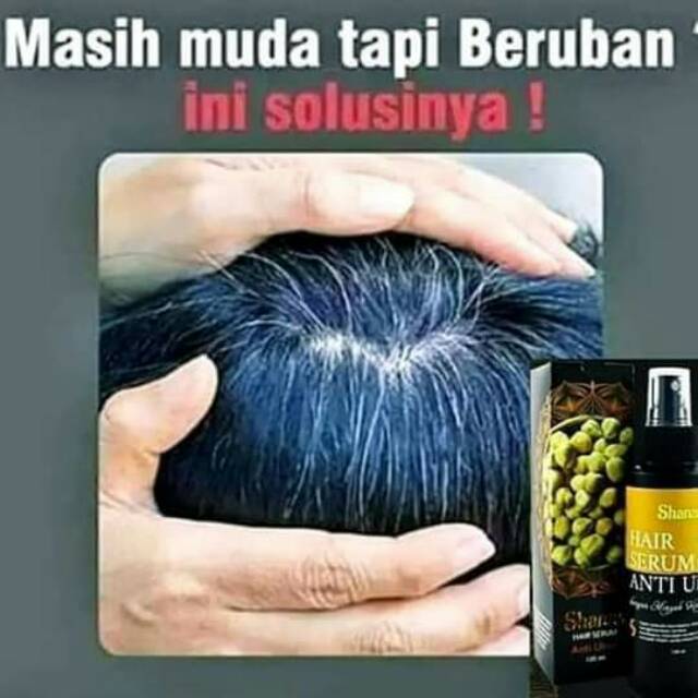 SHANAS HAIR SERUM ANTI UBAN/PENGHILANG UBAN AMPUH RONTOKAN UBAN