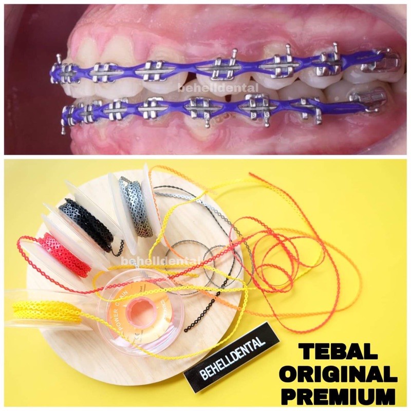 TEBAL KUAT KARET BEHEL POWER CHAIN 1 ROLL / 1 GULUNG PANJANG 4 meter / Karet rantai TARIK / SAMBUNG RUBBER BAND BRACKET GIGI BEHELLDENTAL / Ligature Ties Dental Orthodontic / Rubber Band Tarik Ortho Gigi 1 Gulungan atau Rol / Kawat Braces Behelldental