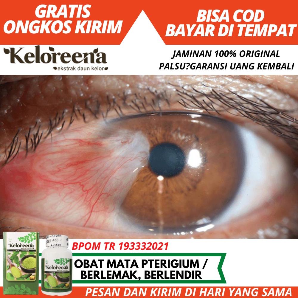 Obat Pembersih Mata, Bersihkan Pterigium dan Mata Berlemak, Obat Mata Berlendir, Bersihkan Lendir Pt